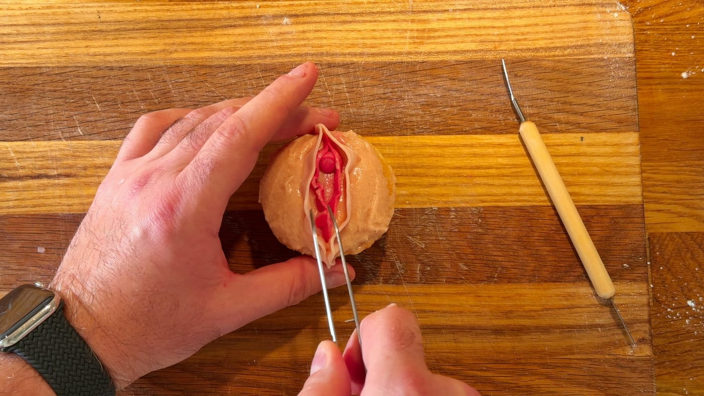 Adjusting the finished vulva with tweezers